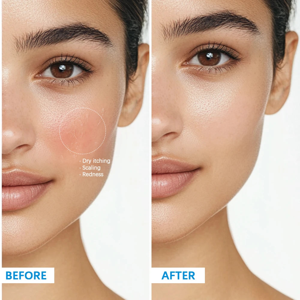 Soothing Multi-Purpose Hydrating Cream Reduces Redness Daily Helps Relieve Rough Cracked Skin Deep Skin Care HIP