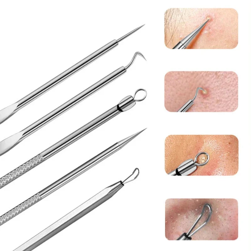 Blackhead & Ingrown Hair Removal Tweezer Kit – 3/8 Pcs Skin Care Tool Set HIP
