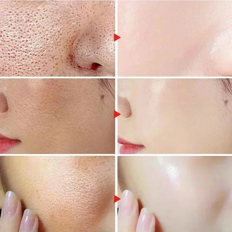 Lactic Acid Pore Minimizing Face Serum – Firm & Smooth Pore Minimizing Serum HIP