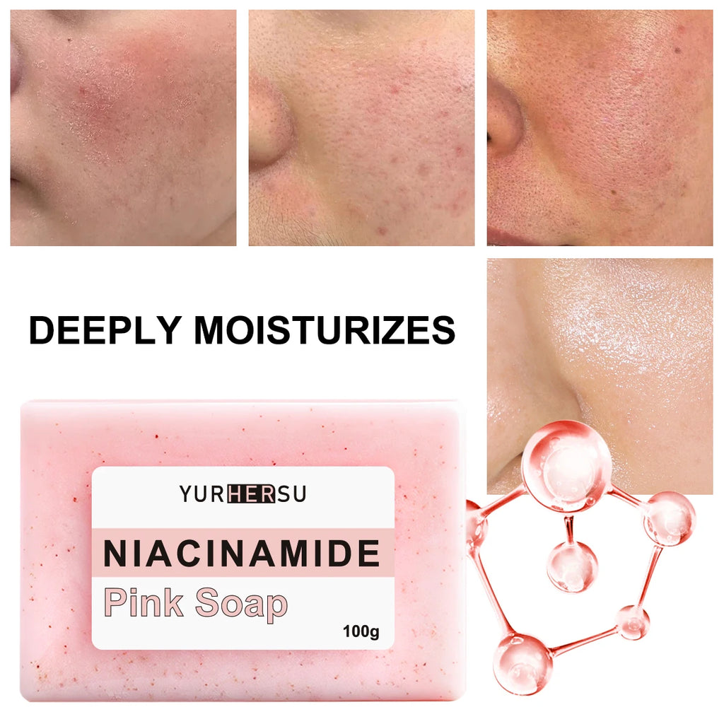 Niacinamide Brightening Soap – Dark Spot & Deep Cleanse Brightening Soap Bar HIP
