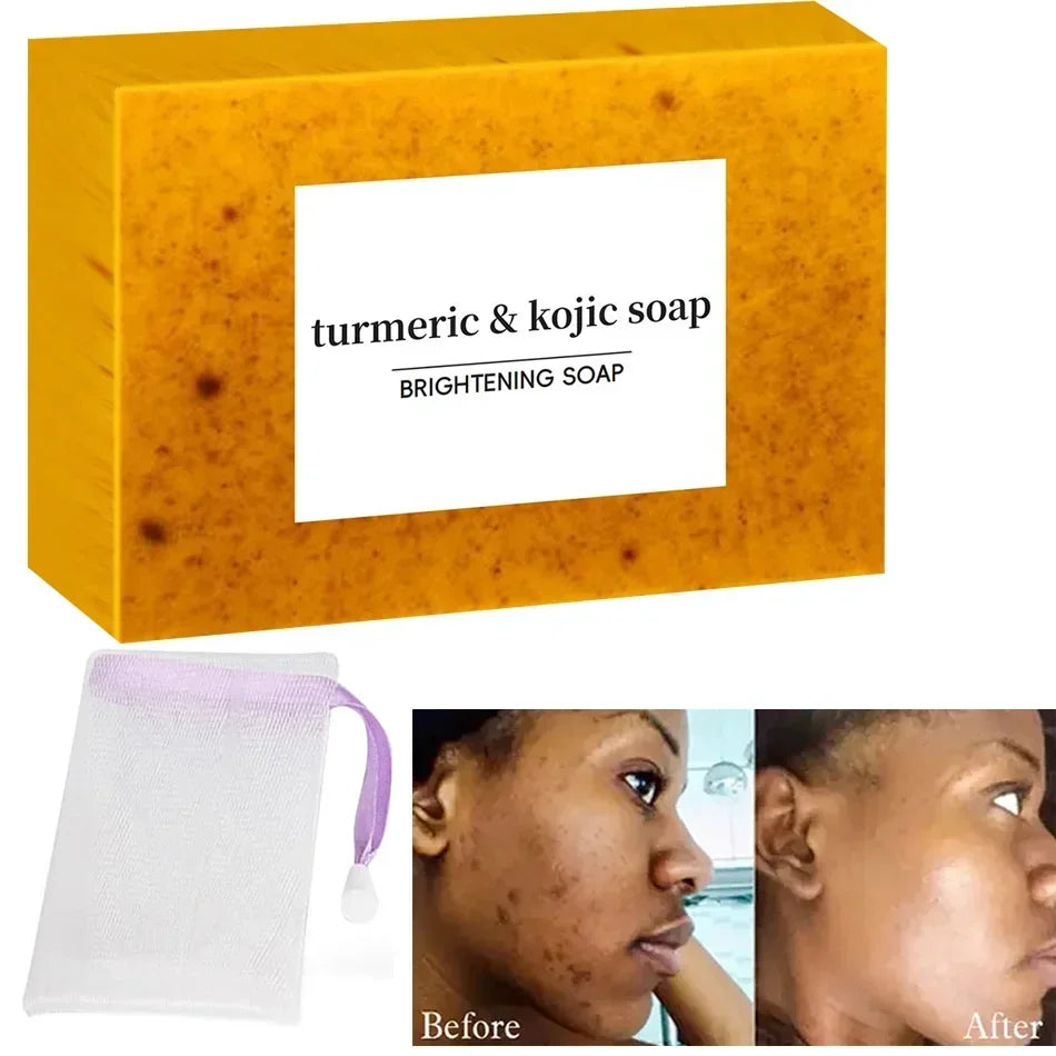 Turmeric Kojic Acid Glow Soap – Brighten & Even Skin Tone Brightening Soap Bar HIP