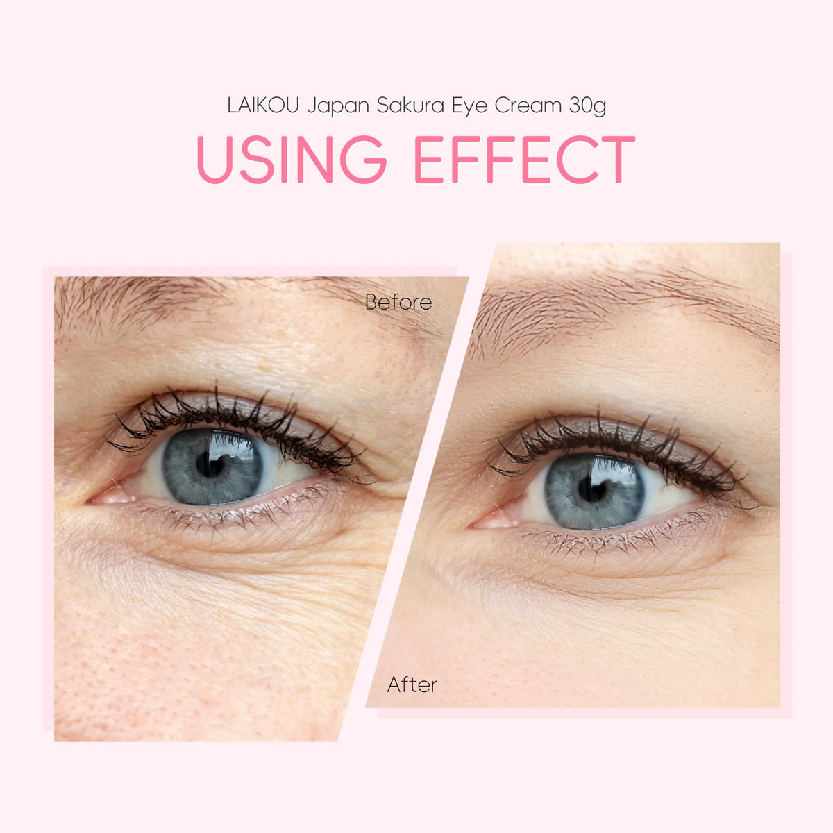 LAIKOU Sakura Anti-Aging Eye Cream 30g – Dark Circles & Wrinkles Eye Cream HIP