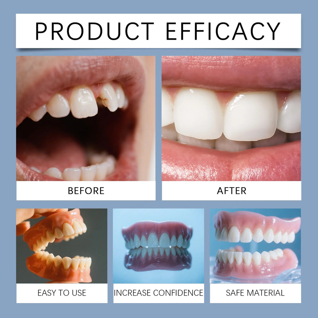 Moldable Denture Repair Kit – Temp Tooth Gap Filler Set Denture Repair Kit HIP