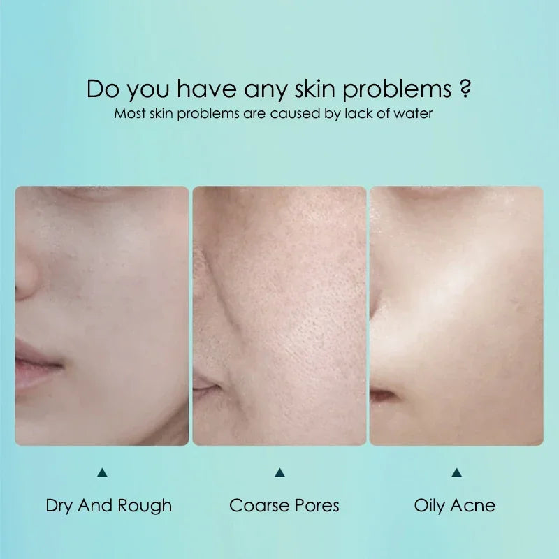 5-Pack Hyaluronic Acid Sheet Masks – Hydrate & Refine Pores Hydrating Sheet Mask HIP
