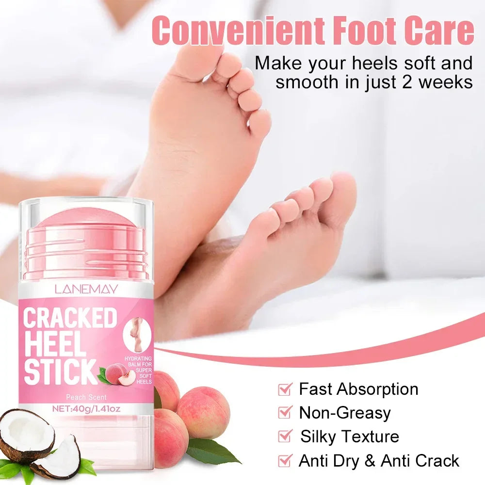 Ultra-Hydrating Foot & Hand Cream – Softens Calluses & Heels Foot & Hand Cream HIP