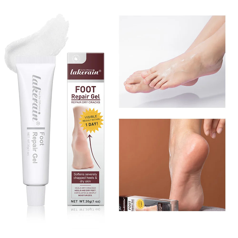 Foot Repair Gel Feet Care Mask Foot Cream Hand Cracked Repair Cream Removal Dead Skin Hand Feet Care Exfoliation 30g HIP 30g