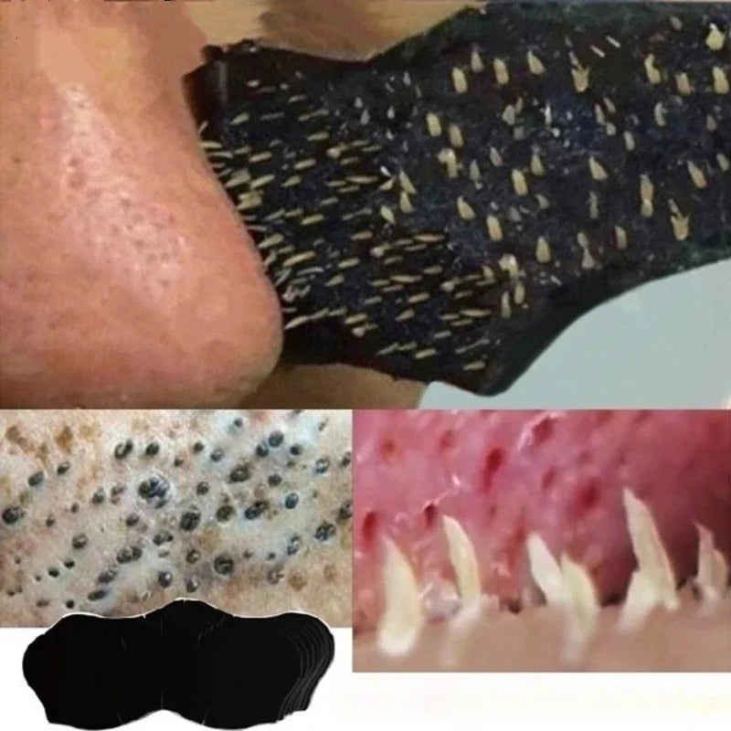 Blackhead Nose Strips – Deep Pore Cleansing | 10–100 Pcs Pore Cleansing Strips HIP