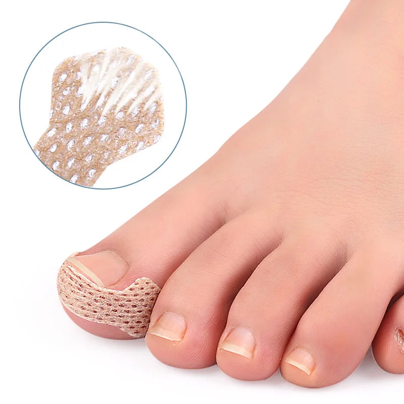 Ingrown Nail Breathable Patches – 10/30/50/100 Pcs | HIP Nail Care Patch HIP