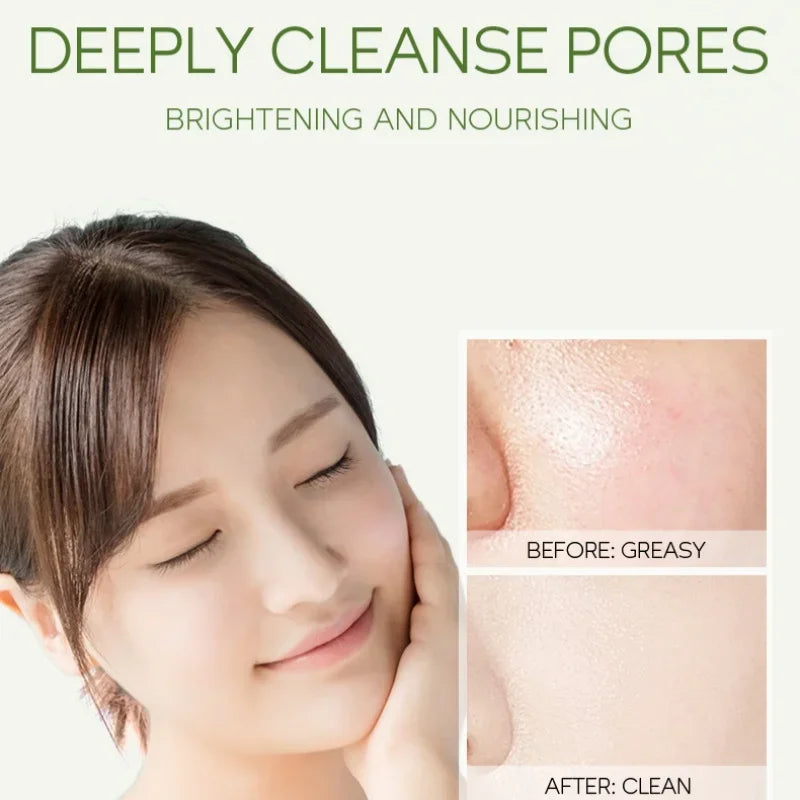 FENYI Green Tea Mud Mask 100g – Pores, Oil Control & Glow Face Mud Mask HIP