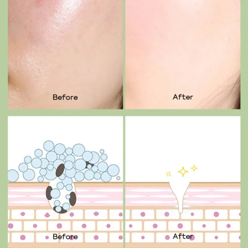 FENYI Green Tea Mud Mask 100g – Pores, Oil Control & Glow Face Mud Mask HIP