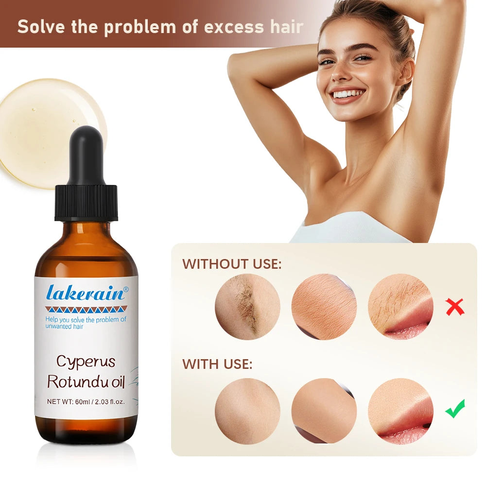 Inhibit Hair Growth 60ml Cyperus Rotundus Oil Nourish the Skin Ingredients are Safe Wide Scope of Application Solve Hair Dense HIP