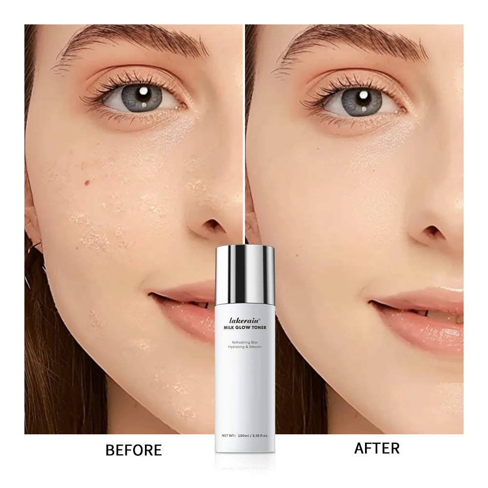 Milk Soothing Toner Moisturizing Water For Face Facial Toner Natural Houttuynia Cordata Extract Refresh Claming Skin HIP