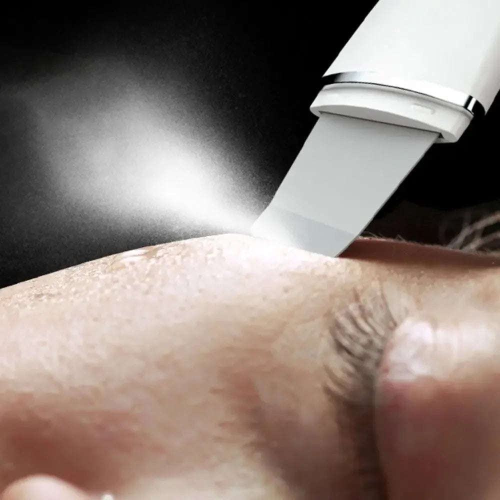 RUZOFO Blackhead Remover & Pore Cleansing Facial Device Facial Cleansing Device HIP