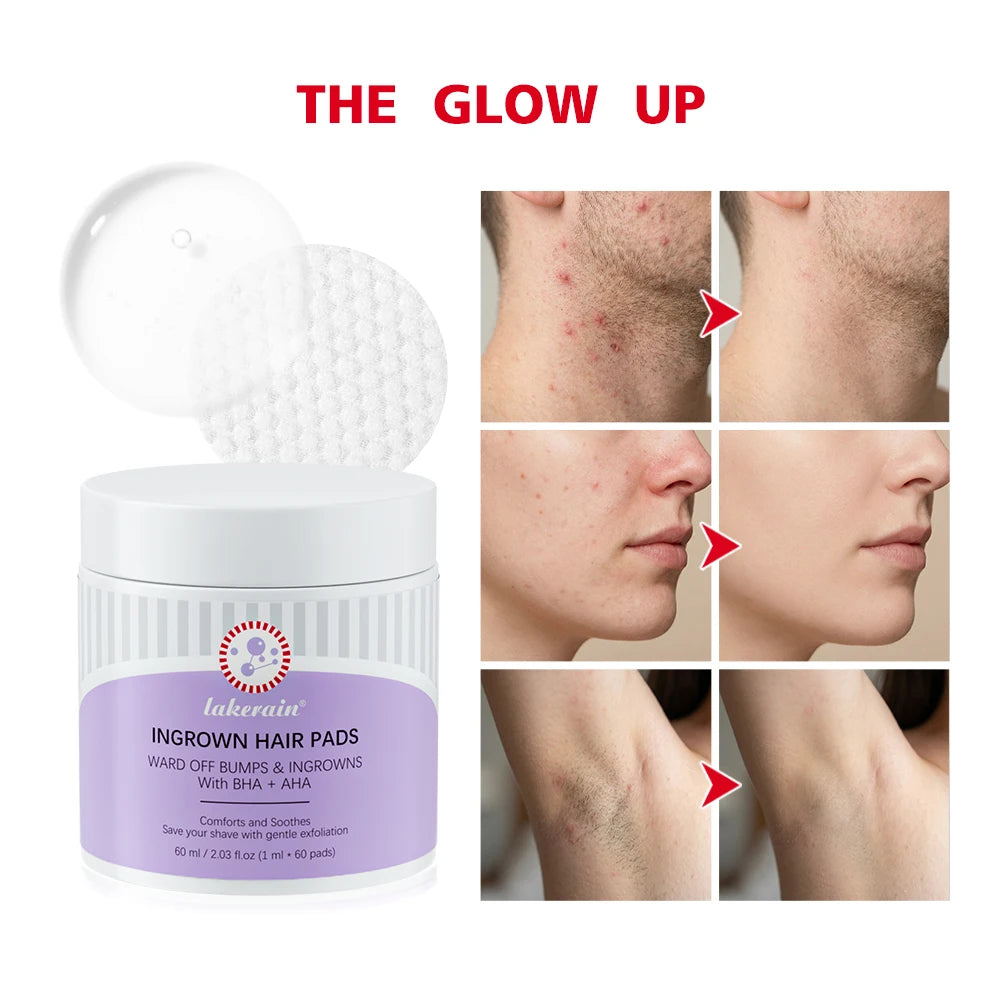 Ingrown Hair Pads Aftershave Treatment Pads to Help Prevent Razor Bumps for Men & Women - Exfoliate Underarms & Bikini Area HIP Default Title