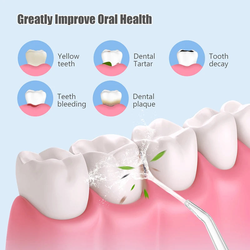Portable Oral Irrigator & Dental Water Flosser | 3 Modes Dental Water Flosser HIP