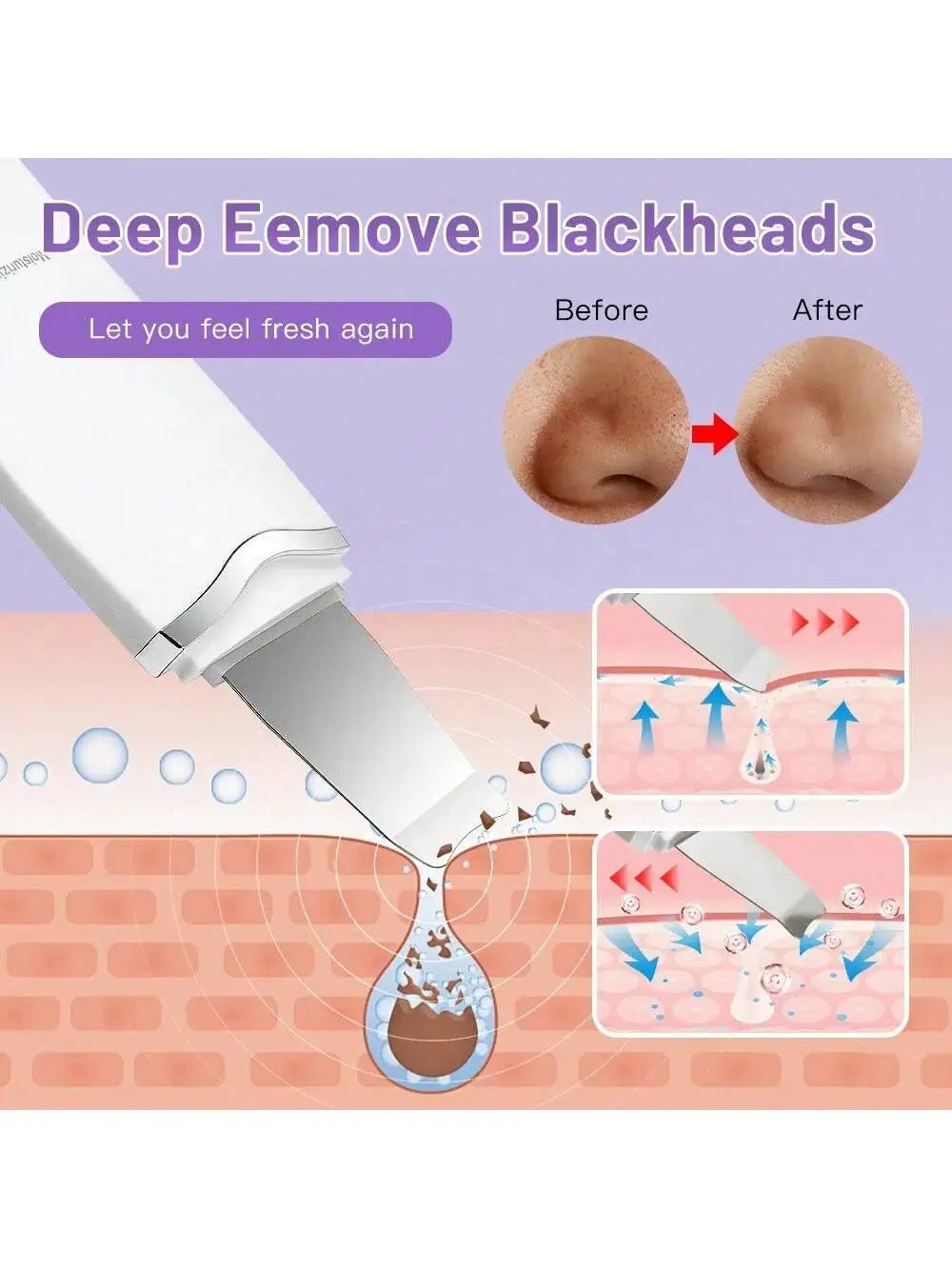 Ultrasonic Skin Scraper – Deep Pore Cleansing Face Device Facial Cleansing Device HIP