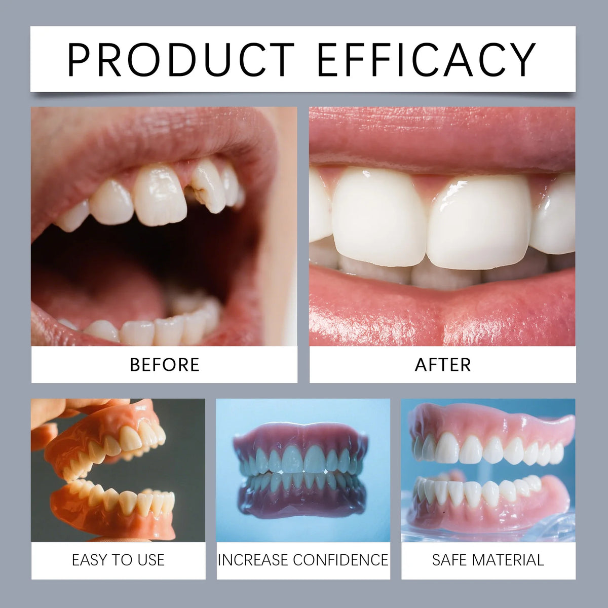 Temporary Denture Reline Kit – Full Upper & Lower Veneer Cover Denture Reline Kit HIP