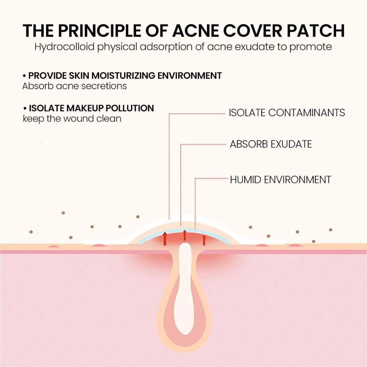 240pc Count Star Heart-Shaped Acne Patches Assorted Sizes Colors with Tea Tree Salicylic Acid & Mica Oil Alcohol-Free for All HIP