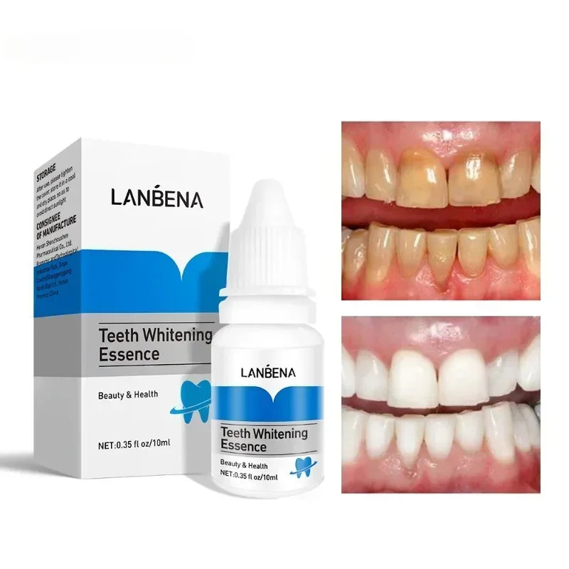 Teeth Whitening Serum – Remove Stains & Freshen Breath Teeth Whitening Serum HIP