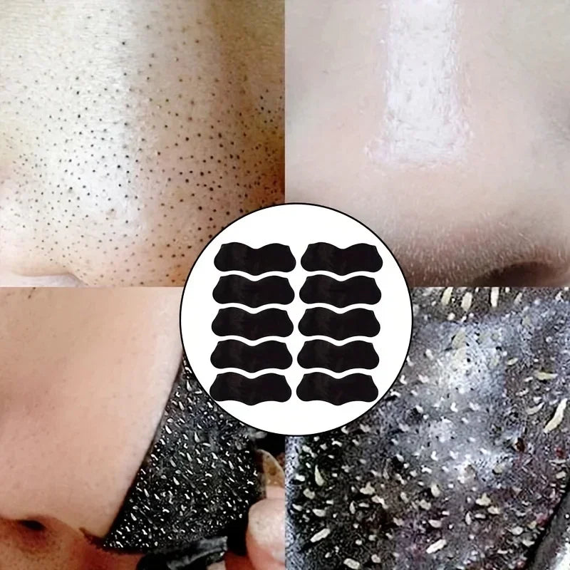 Blackhead Nose Strips Deep Cleansing Pore Strips 10–100 Pack Blackhead Pore Strips HIP