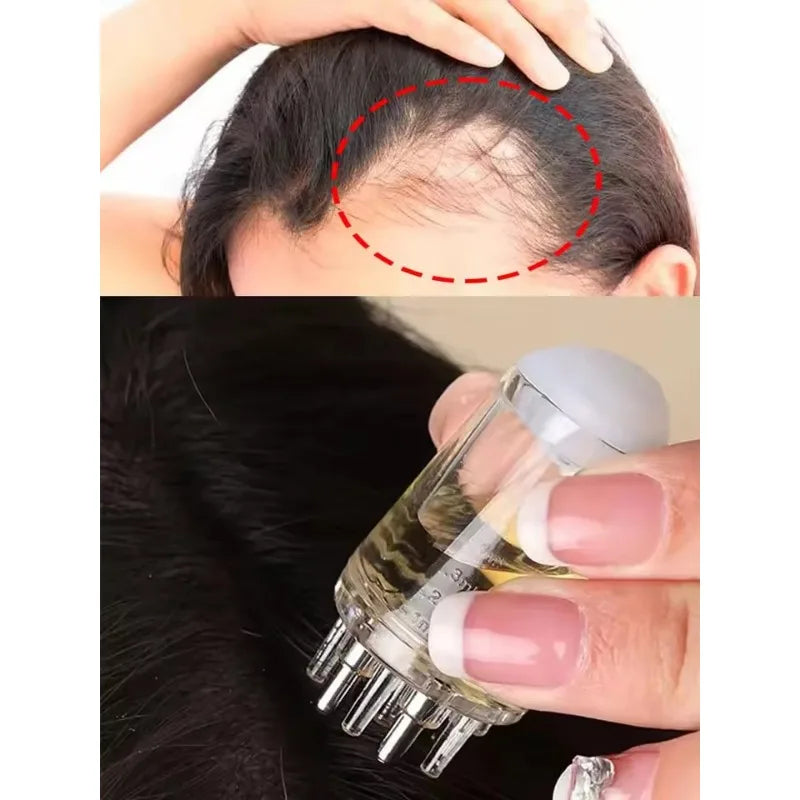 RUZOFO Scalp Applicator Comb – Hair Serum & Oil Dispenser Scalp Applicator Comb HIP