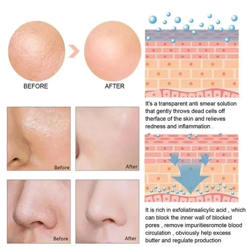 Lactic Acid Pore Minimizing Face Serum – Firm & Smooth Pore Minimizing Serum HIP
