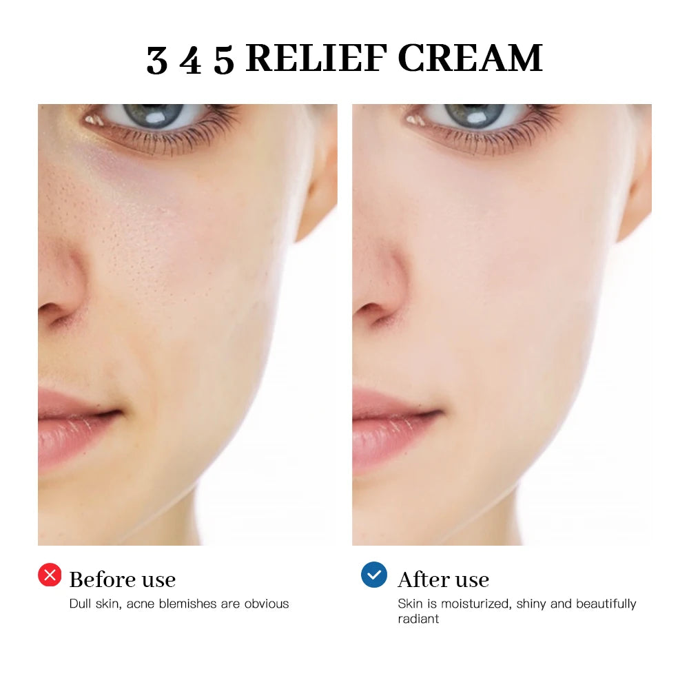 345 Relief Cream Comprehensive solution to skin problems Anti-sugar and antioxidant Brightening skin Improving acne marks Moistu HIP