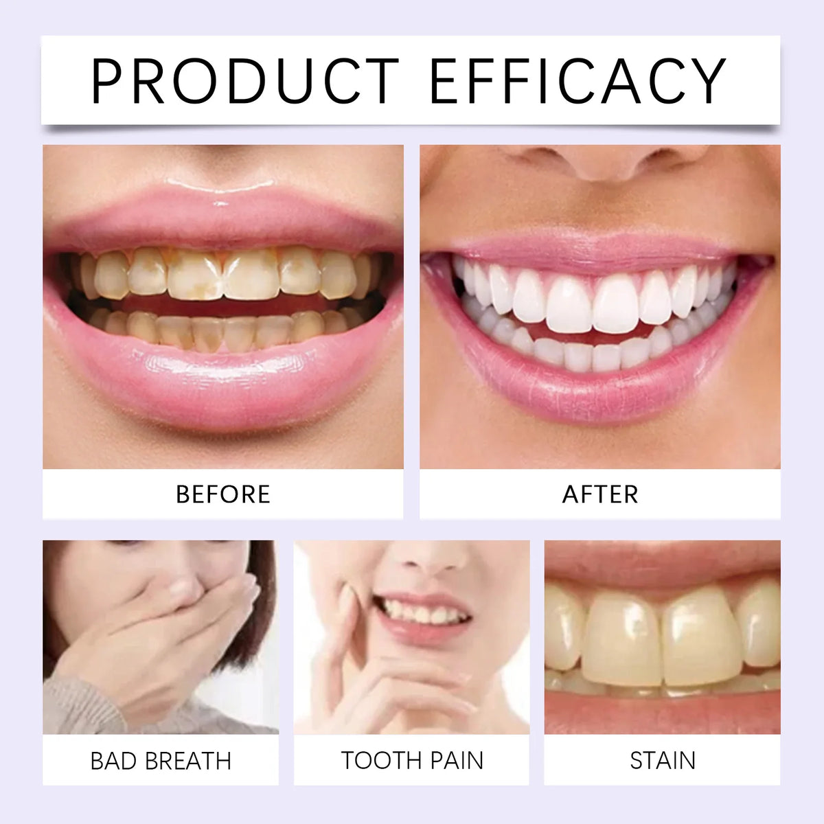 Teeth Whitening Strips – Gentle Stain Removal, 7 Pairs Teeth Whitening Strips HIP