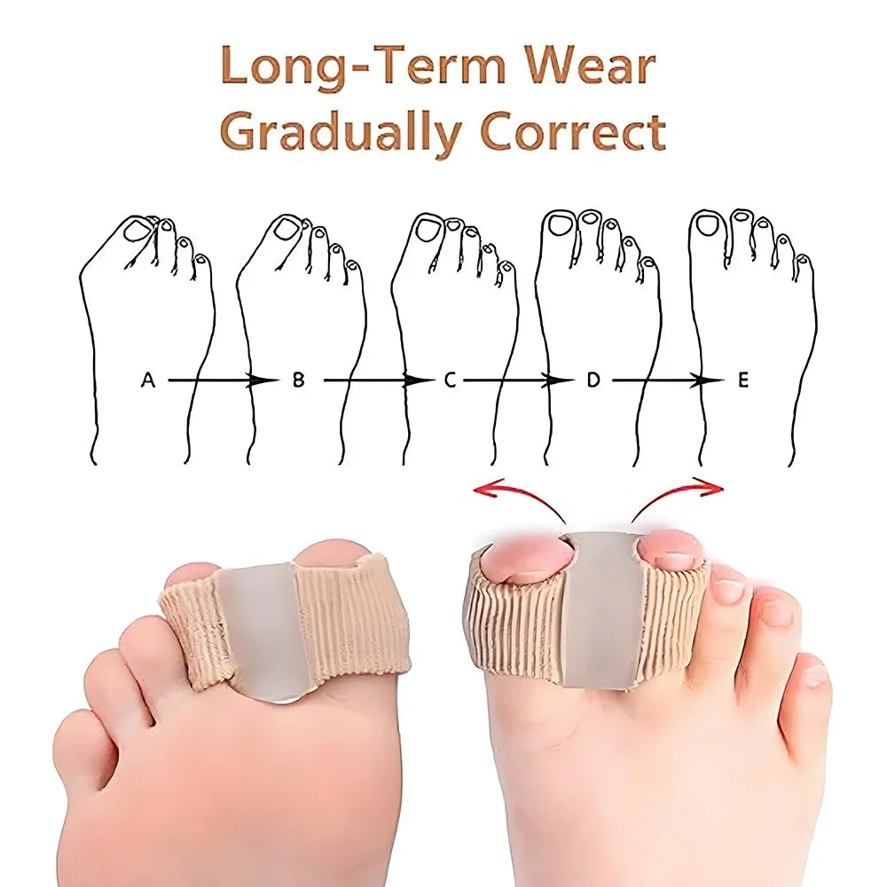 Gel Toe Separator & Big Toe Straightener Brace – 2/4 Pack Toe Separator Brace HIP