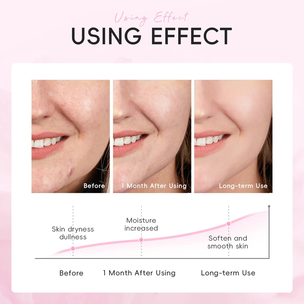 LAIKOU Sakura Moisturizing Face Mask 10 Pack – Deep Hydration Hydrating Face Mask HIP
