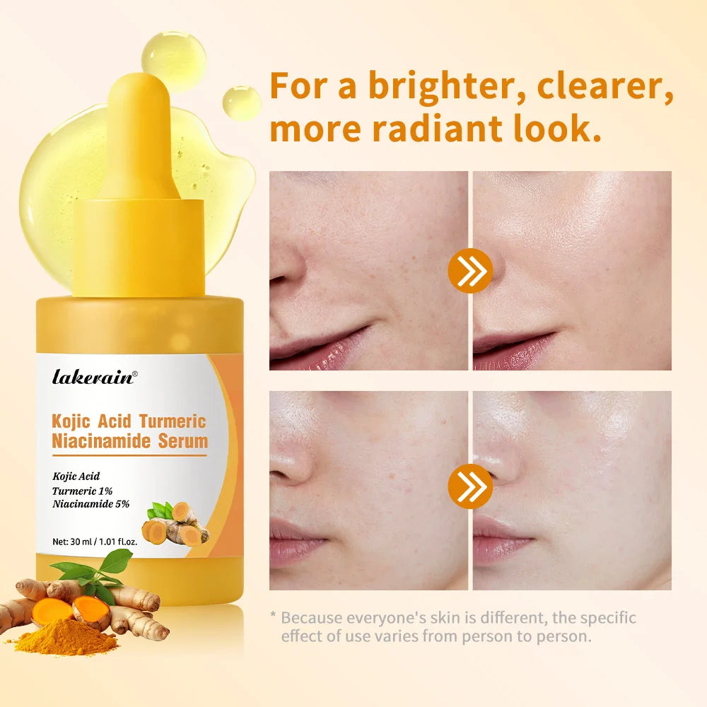 Kojic Acid Turmeric Serum Niacinamide Glow Capsules Brightening Hydration Balancing Skin Barrier Soothing Troubled Facial Care HIP