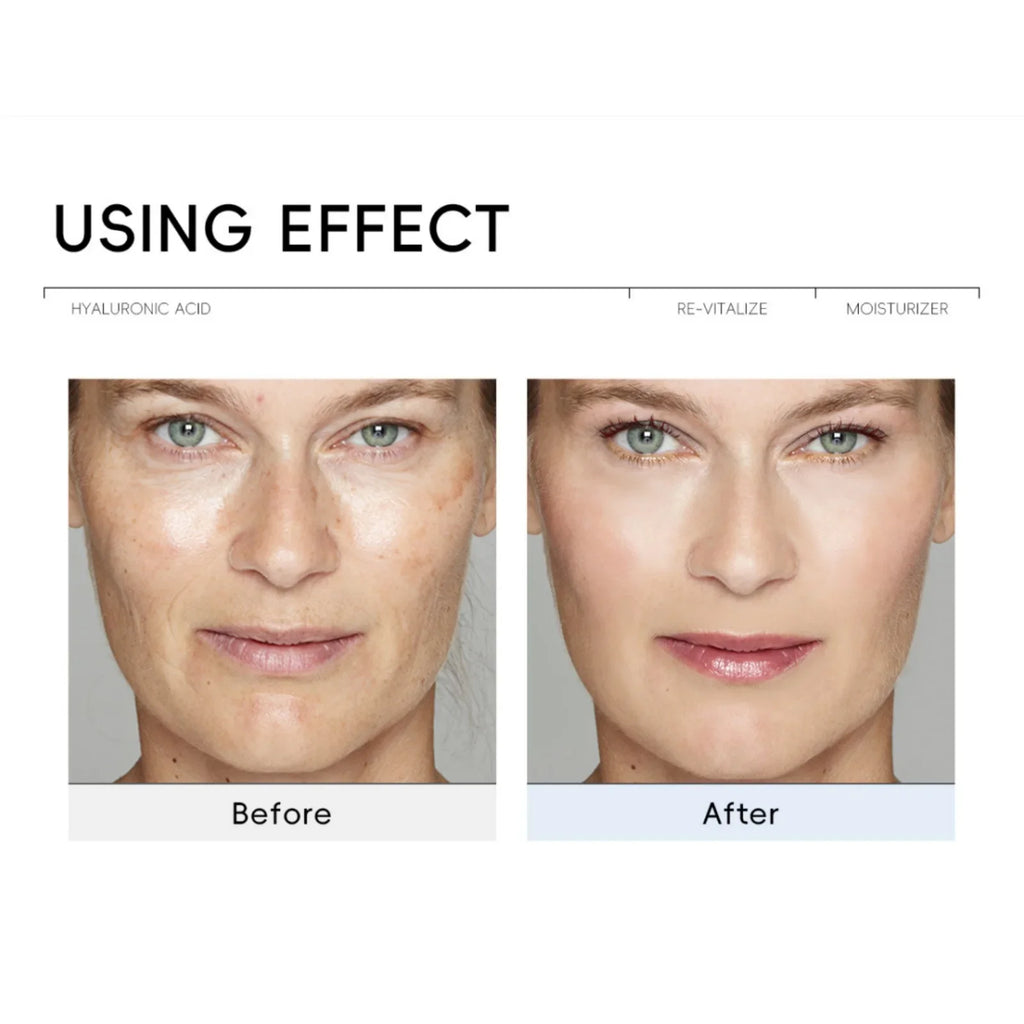 QUIYUM Hyaluronic Acid Face Cream – Hydrate & Brighten Hyaluronic Acid Face Cream HIP