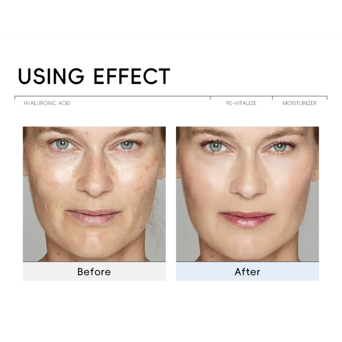 QUIYUM Hyaluronic Acid Face Cream – Hydrate & Brighten Hyaluronic Acid Face Cream HIP