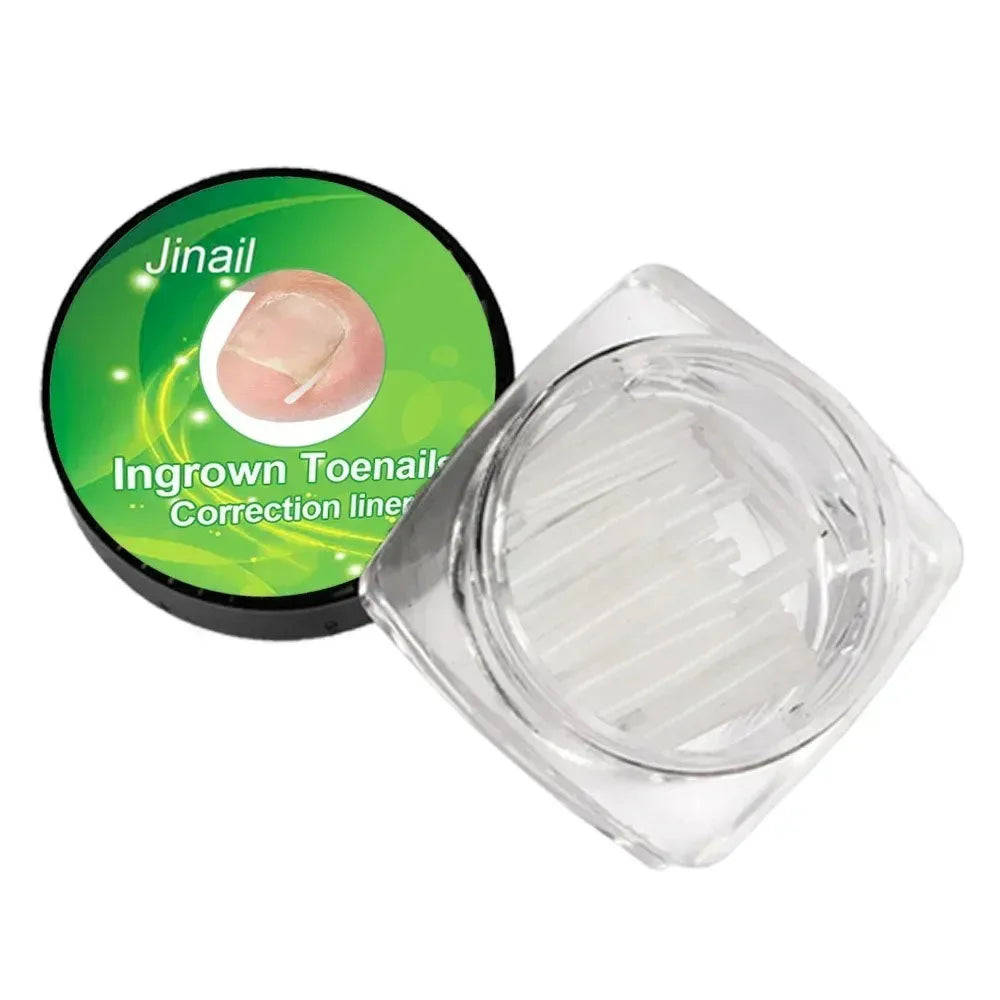 Ingrown Toenail Correction Patches – Ultra-Thin Elastic Stickers Toenail Correction Patch HIP C593-30pcs