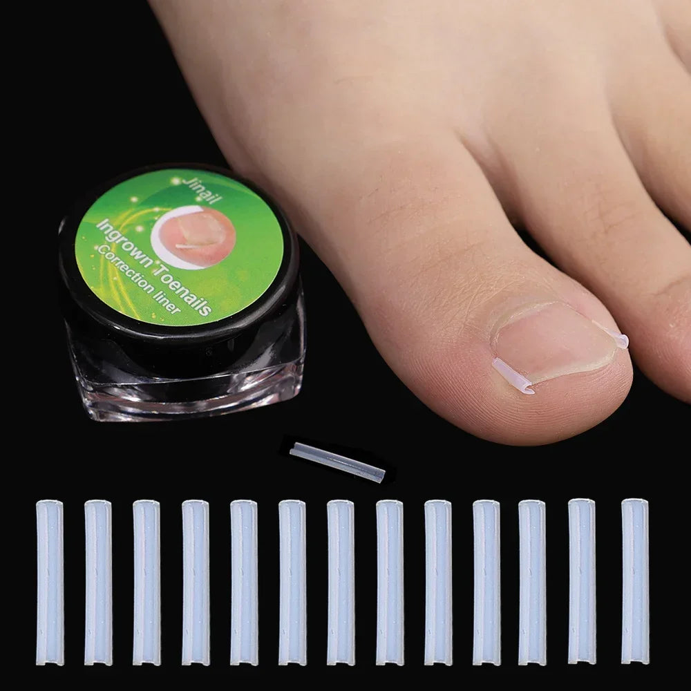 Ingrown Toenail Correction Patches – Ultra-Thin Elastic Stickers Toenail Correction Patch HIP