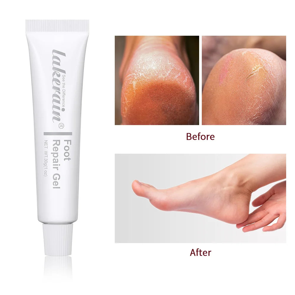 Foot Repair Gel Feet Care Mask Foot Cream Hand Cracked Repair Cream Removal Dead Skin Hand Feet Care Exfoliation 30g HIP