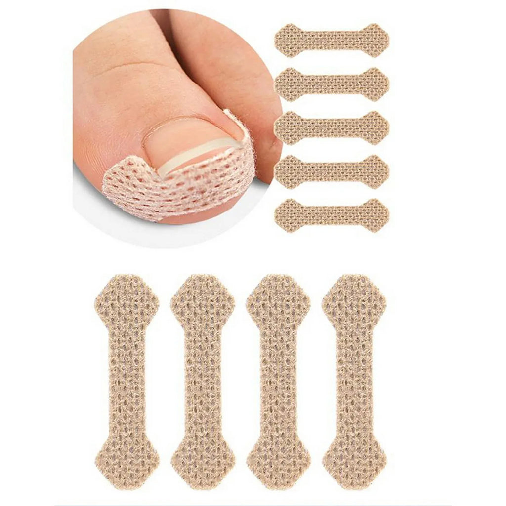 Ingrown Nail Breathable Patches – 10/30/50/100 Pcs | HIP Nail Care Patch HIP