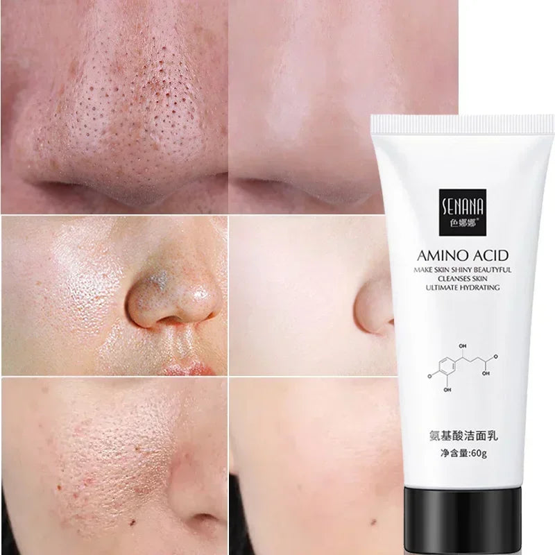 Nicotinamide Amino Acid Face Cleanser – Oil Control & Pores Facial Cleanser HIP