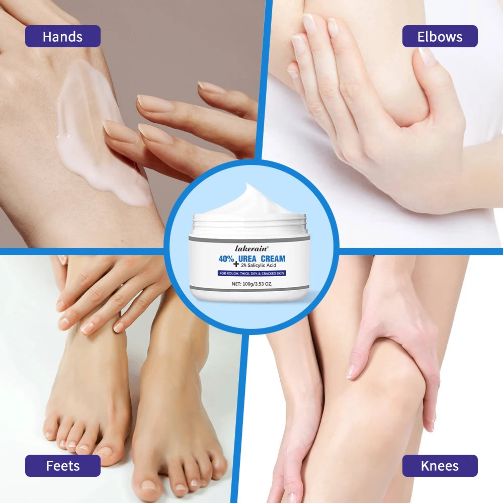 New 42% Urea Cream + 2% Salicylic acid Foot and hand Moisturizer, deep moisturizer and Nourishing moisturizer HIP