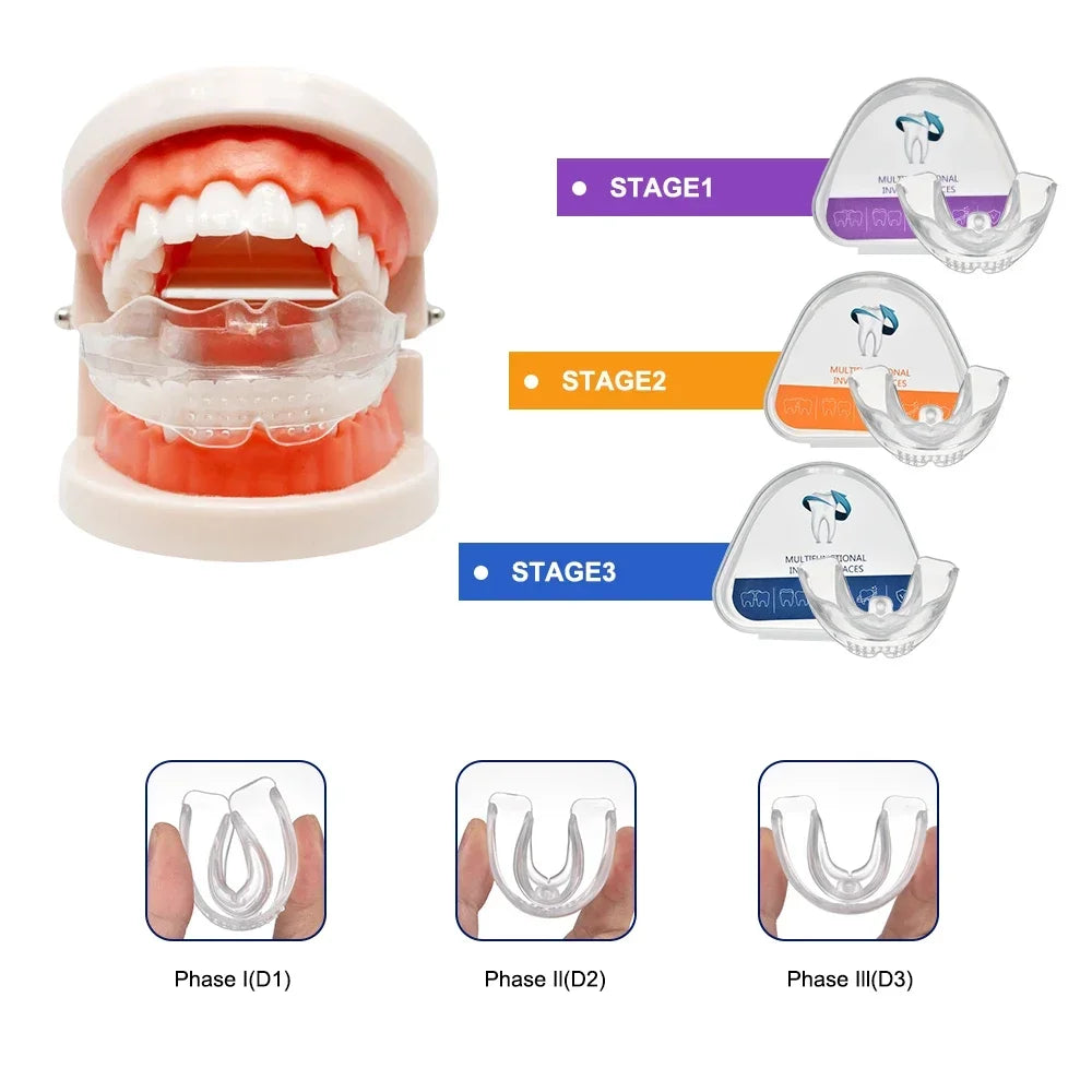 3-Stage Transparent Teeth Trainer Braces for Adults | Set of 3 Teeth Alignment Trainer HIP